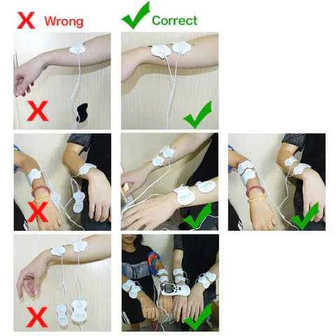 ElectroPulse Therapy